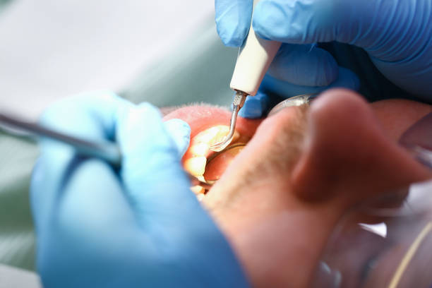 Best Emergency Dental Surgery in Chandler, OK