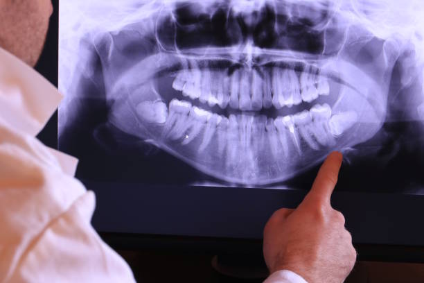 Best Emergency Root Canal Treatment in Chandler, OK
