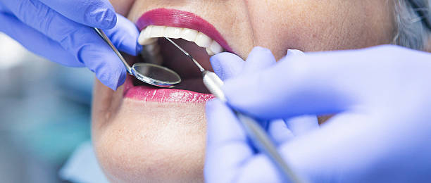 Best Emergency Wisdom Teeth Removal in Chandler, OK